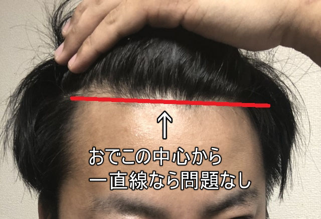 正常なレットダウン反射とは何ですか?